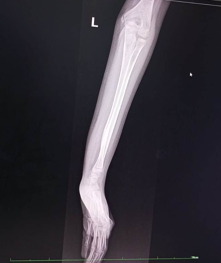 Children receiving routine vaccinations at Lillian Foundation monthly clinic